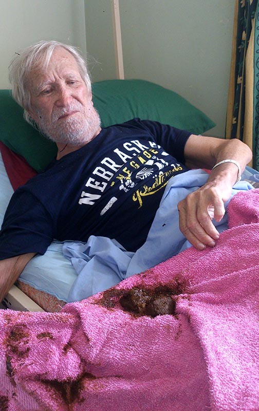 Dennis Byrne (71) with his own faeces in a towel at Stanger Hospital.