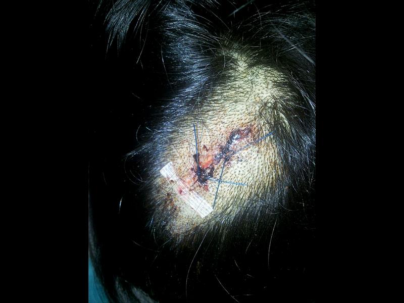 Sheriff's wife needed stitches after passing out and hitting her head in the bathroom a few hours after her caesarean.