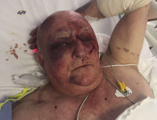 Simon Shepherd was attacked in his home in at their home situated on a farm in Misty Ridge, upper Tongaat.