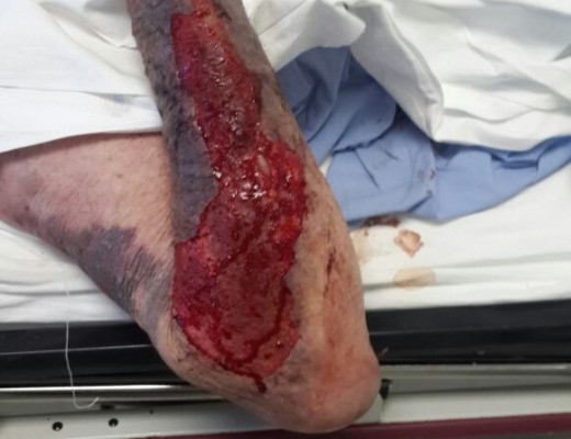 Simon was beaten with a cane knife.