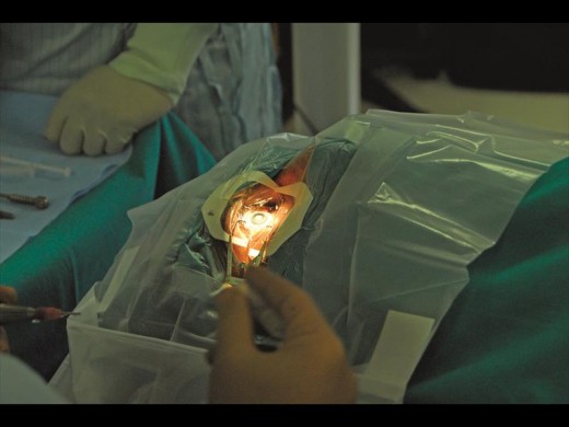 Dr Malcolm Carey performs cataract surgery on a patient.