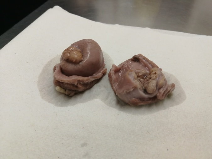 A spirocerca nest.