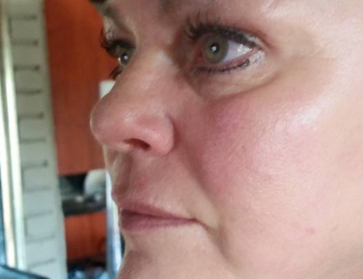 She was punched in the head several times. PHOTO: Elma Nel