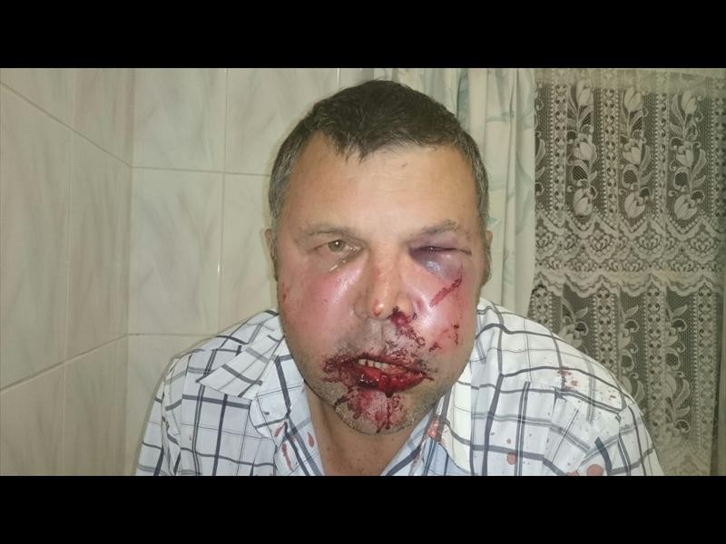 Dries Laas na hy deur drie mans in die ooste van Pretoria aangeval is. Foto: Verskaf