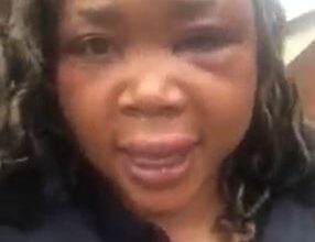 Assaulted woman shares video claiming local police do not want to help her