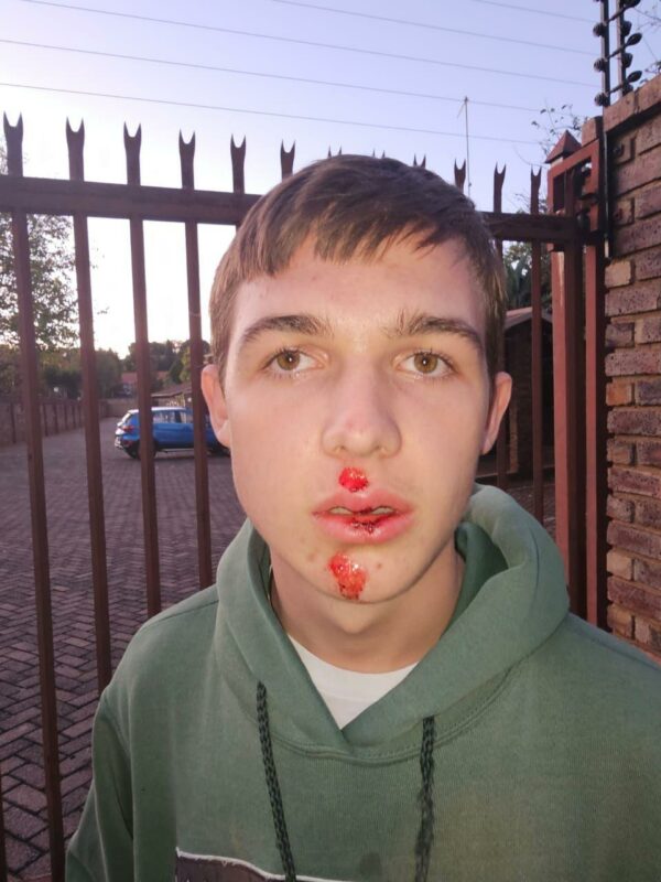 “He went face first into the tar.”