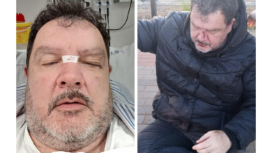 Man allegedly attacked by taxi driver in Wonderboom