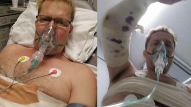Pretoria singer severely injured after falling into campfire