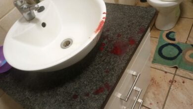 A man was severely assaulted with a panga at his business premises in Pretoria West. Here is more information.