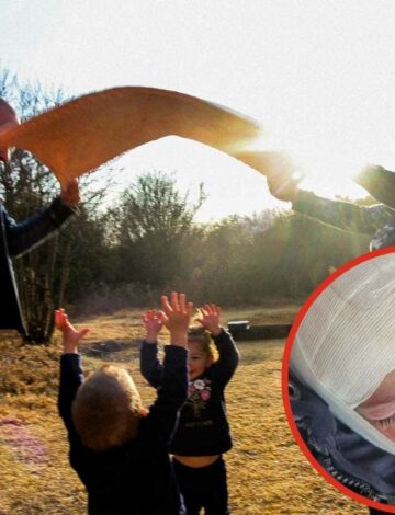Centurion toddler severely burned in freak accident