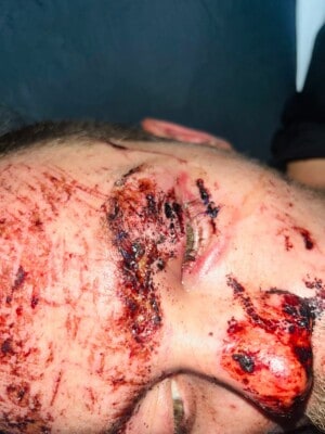 Pretoria man alleges trauma, dehydration, and abuse at Steve Biko Hospital after accident. Photo: Supplied