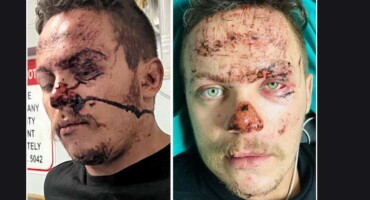 Pretoria man alleges trauma, dehydration, and abuse at Steve Biko Hospital after accident