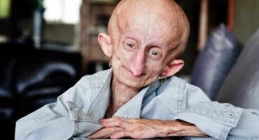 The beloved and inspiring young Beandri Booysen (19)