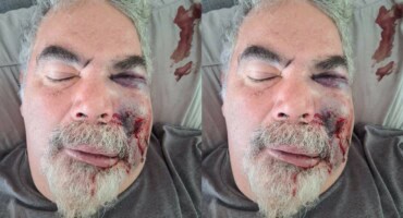 Man arrested for brutal assault on local singer's father-in-law