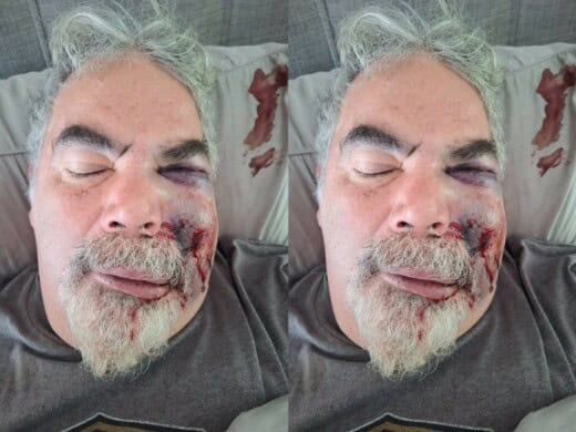 Man arrested for brutal assault on local singer’s father-in-law
