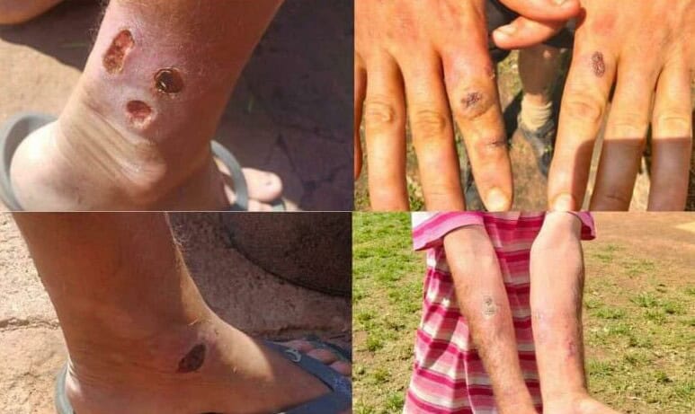 Health dept urges for calm amid disease outbreak concerns in Pretoria ...