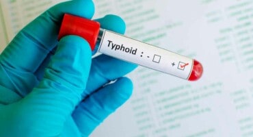 Typhoid spike in Tshwane: Here’s what you need to know about the symptoms
