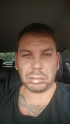 Well-known Weather hooligan rushed to hospital after near-fatal wasp sting