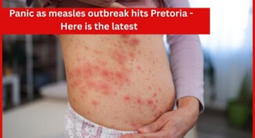 Panic as measles outbreak hits Pretoria - Here is the latest
