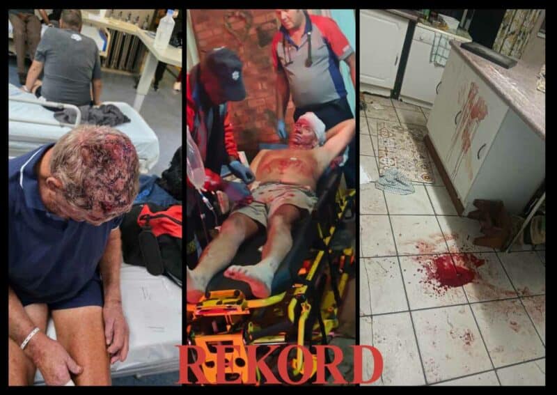 Elderly Pretoria couple brutally attacked on smallholding