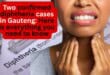 Two confirmed diphtheria cases in Gauteng: Here is everything you need to know