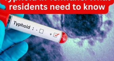 Typhoid in Tshwane: What residents need to know