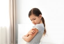Help: My child suffers from atopic eczema!