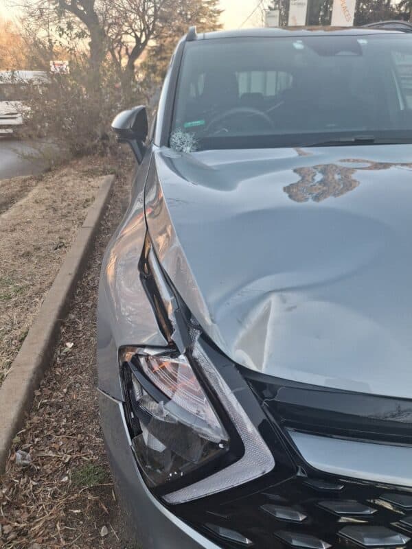 A man was injured after being hit by a car in Blairgowrie when a friend playfully pushed him into the road during a walk.