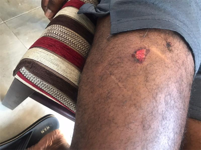 Three-armed suspects broke into a property on Gertrude Street, shooting and injuring a houseowner before fleeing into overgrown bush.