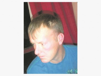 Na aanleiding van dié merk aan mnr. Kotze se gesig, beweer hy en sy familie dat hy deur sekuriteitspersoneel aangerand is.