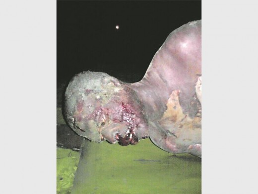 Lucky Motha is lucky to be alive. He is still recovering in hospital.
