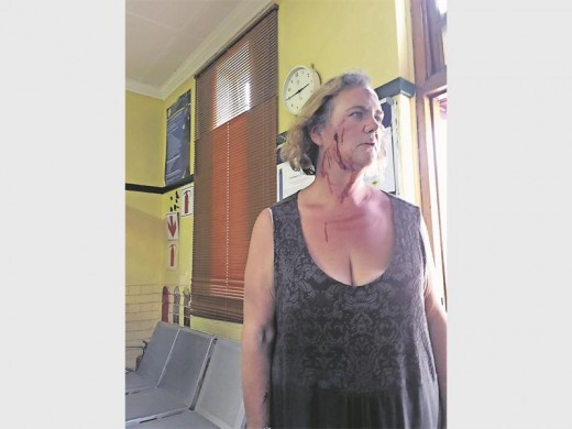 Lindy van der Walt also bled from her head after she was assaulted with a sjambok. (Cellphone image).