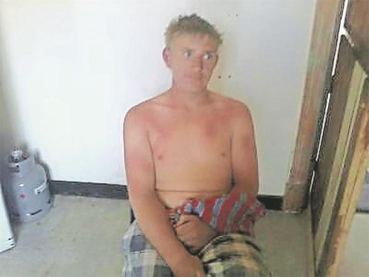 Jonathan de Beer shortly after he was attacked with boiling water. (Cellphone image)
