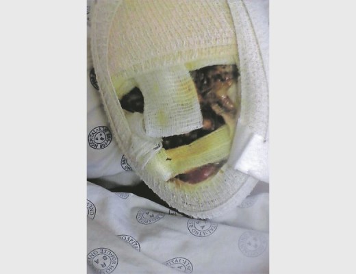 Linah Skhosana in ICU after the attack. 
