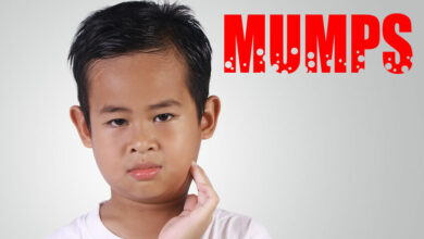 Does my child have mumps?