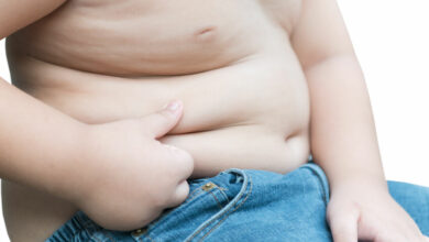 The emotional toll of obesity in children