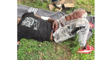 The man who was stabbed with a broken bottle.