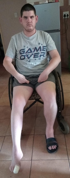 A young man in a wheenchair after he had a stroke after an operation.
