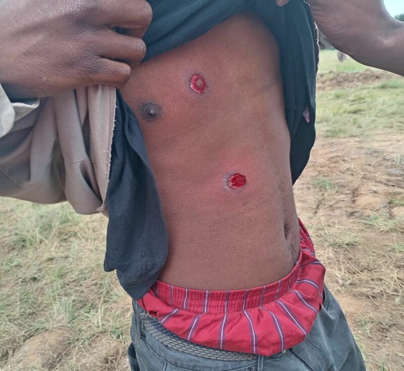 Paardeplaats residents blasted with rubber bullets during water protest