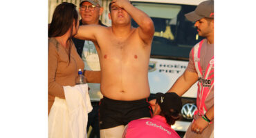 A shirtless rugby player appears injured, holding his head with a pained expression. He is surrounded by concerned onlookers and teammates in sports attire.