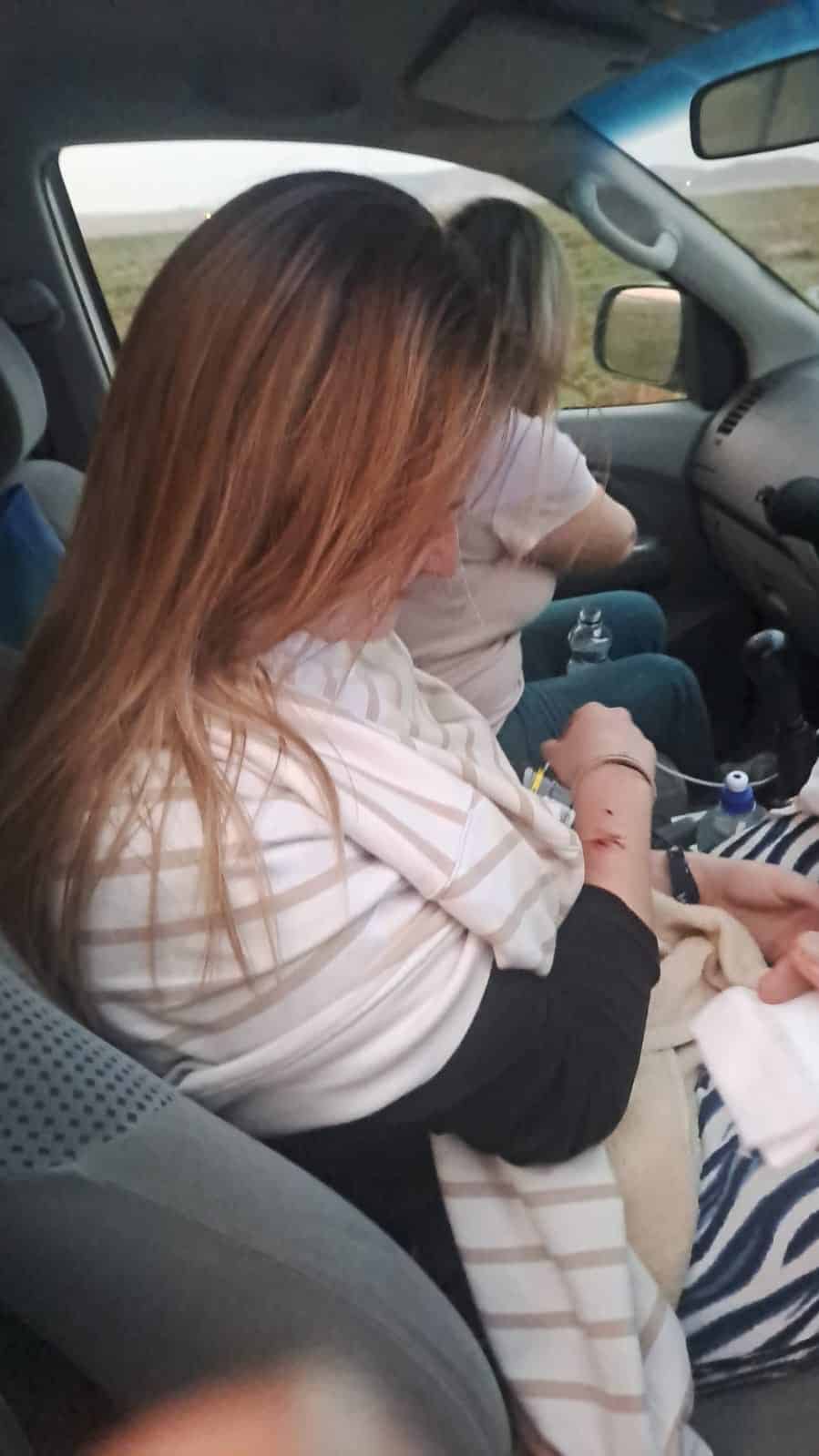 Charissa Terblanche wys haar ligte beserings ná die motorrol buite Balfour.