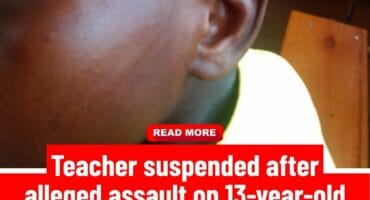 Injured learner from Davel with blurred eyes to protect identity