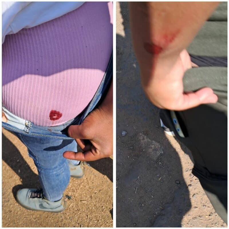 Two unidentified individuals with bleeding injuries at the Ermelo protest scene on June 10.