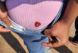 Close-up of bleeding wound on protester’s body in Ermelo