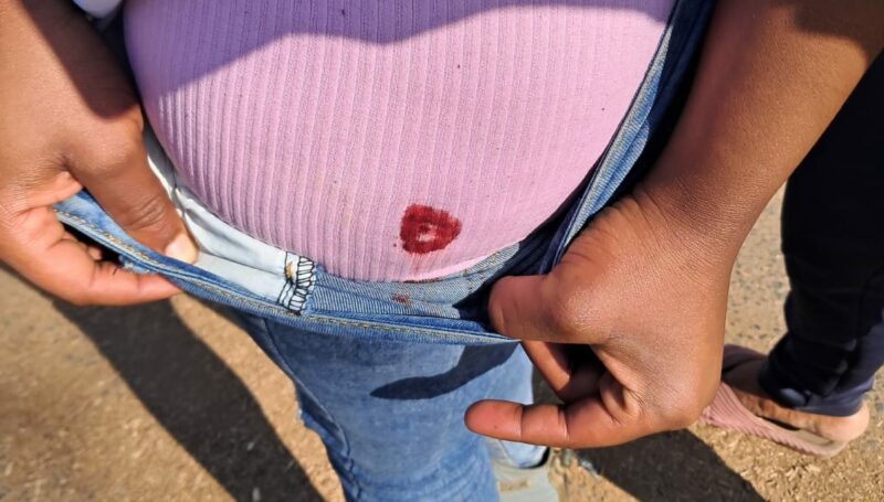 Close-up of bleeding wound on protester’s body in Ermelo