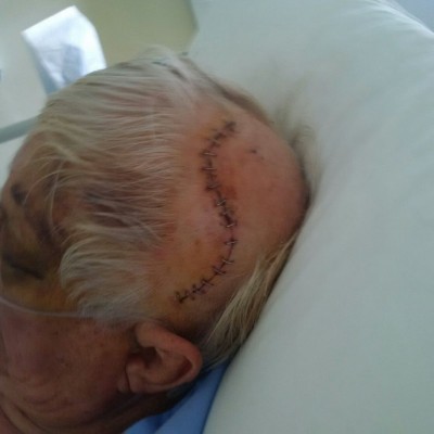 Mnr. Larry Ryan na die operasie.