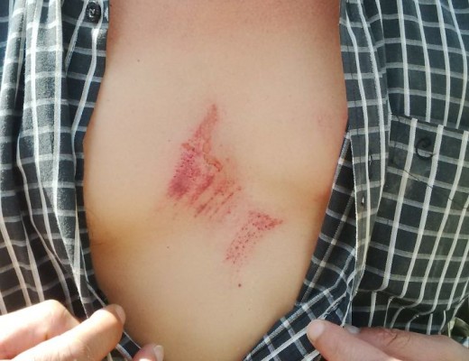 A Kinross resident living in the same street at Mr Sol Vilakazi was allegedly attacked by a member from the Vukta Taxi Association while he was walking in the street.