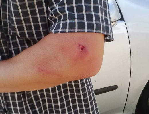 A Kinross resident living in the same street at Mr Sol Vilakazi was allegedly attacked by a member from the Vukta Taxi Association while he was walking in the street.