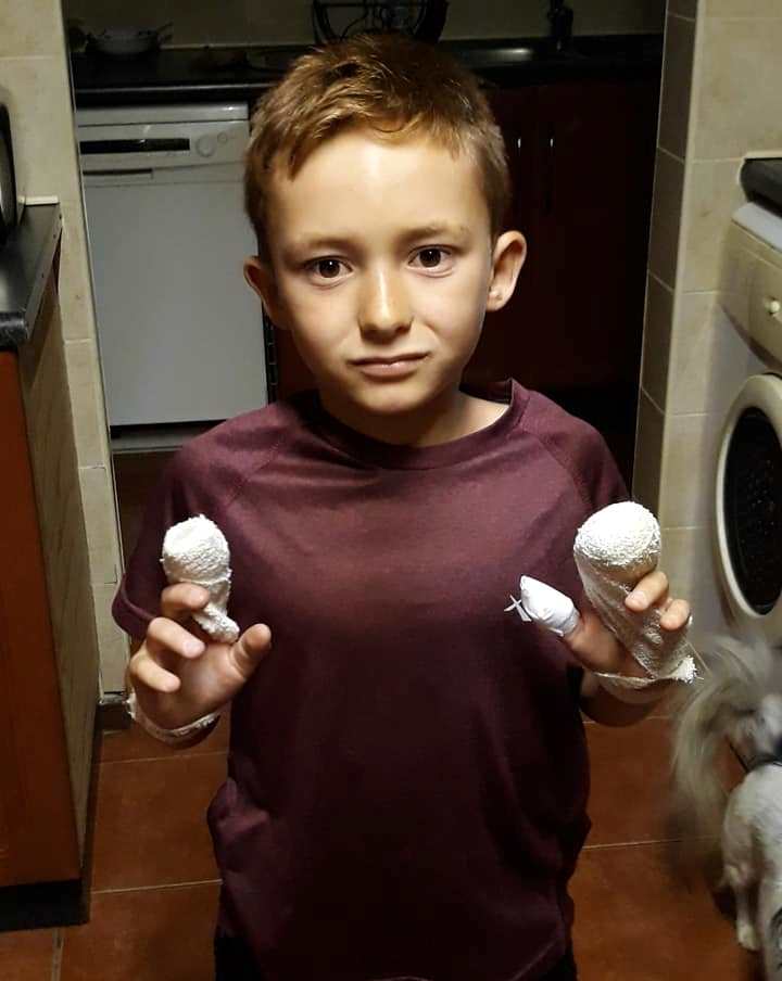 [GRAPHIC CONTENT] Starting gun’s cap explodes in Secunda boy’s hands