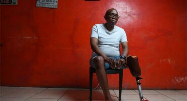 man with a amputated leg